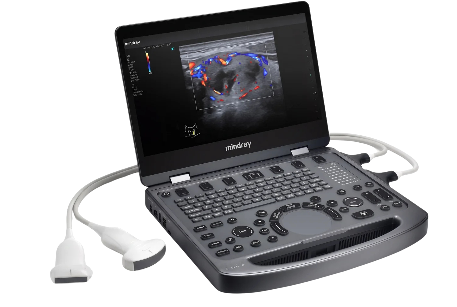Mindray MX3 completo sobre negro