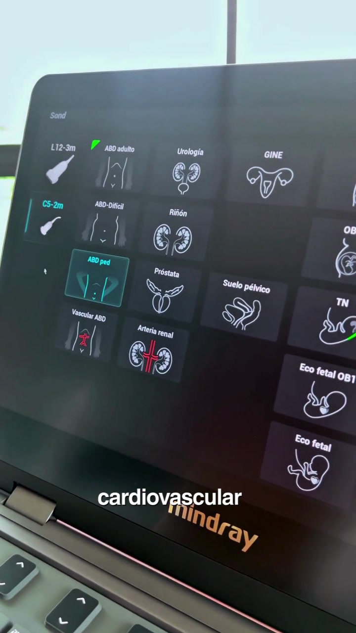 Mindray MX3: Interfaz