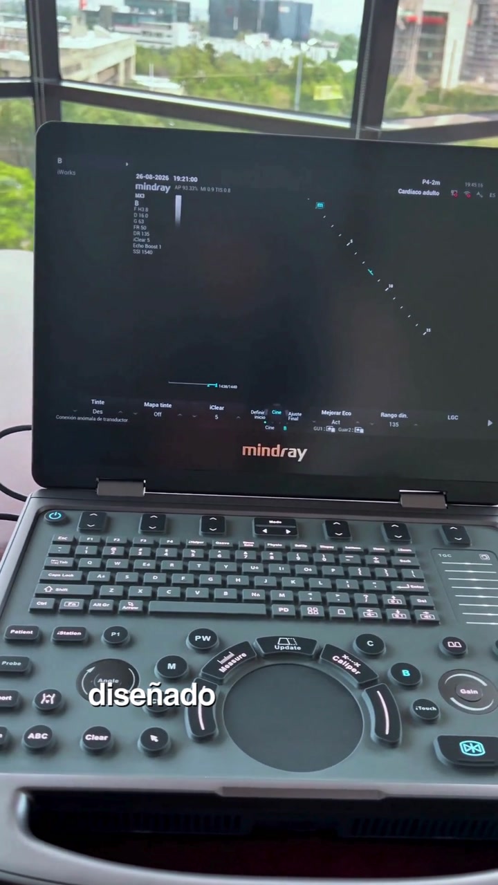 Mindray MX3: Diseño