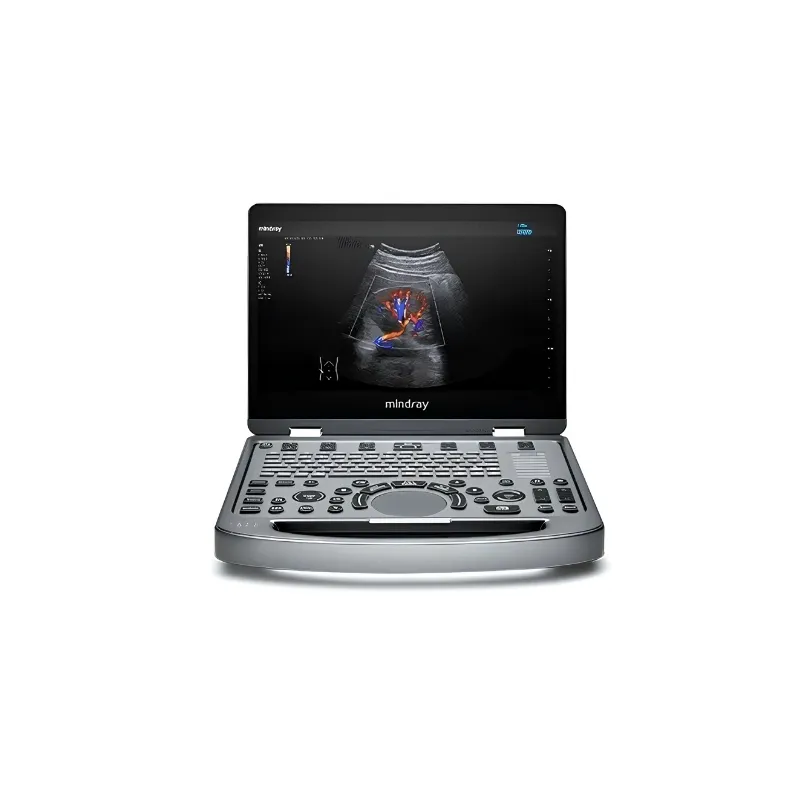 [UPM-UL473-P] Ultrasonido Portátil Mindray MX3