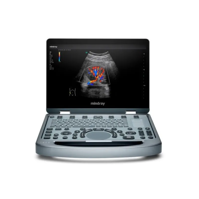 [UPM-UL505-P] Ultrasonido Portátil Mindray MX5