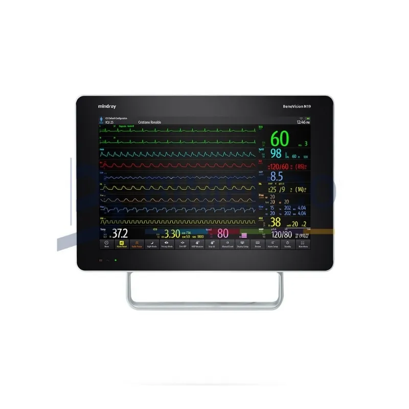Monitor de Paciente Mindray BeneVision N19