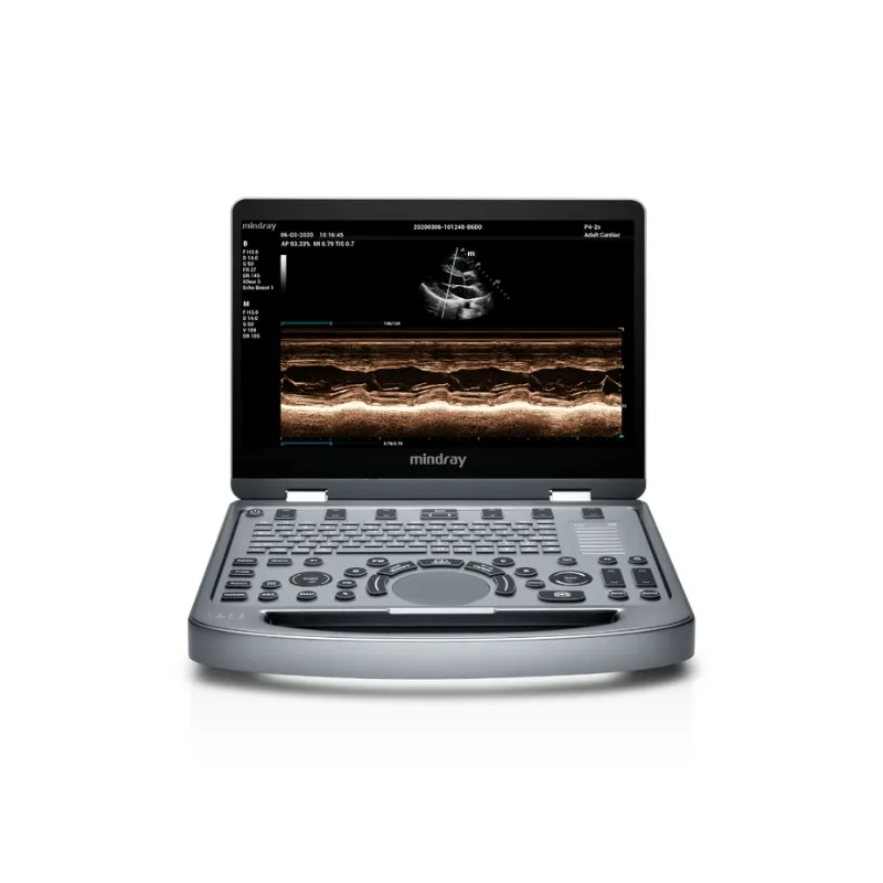 Ultrasonido Portátil Mindray MX6