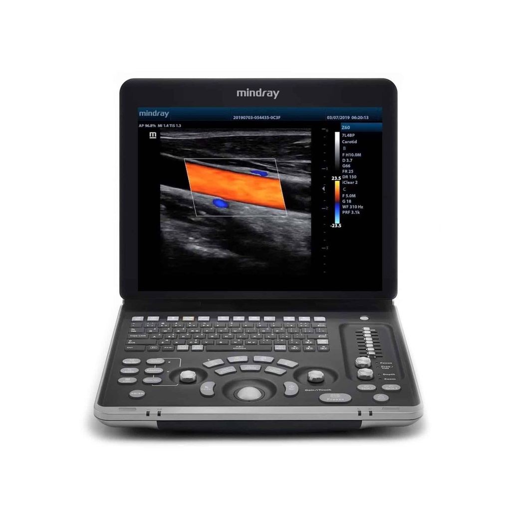 [UPM-UL058-C] Ultrasonido Portátil Mindray Z60